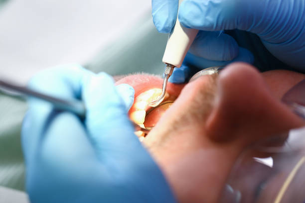 Best Weekend Emergency Dentist in Waxahachie, TX