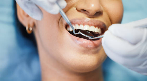 Best Emergency Tooth Extraction in Waxahachie, TX