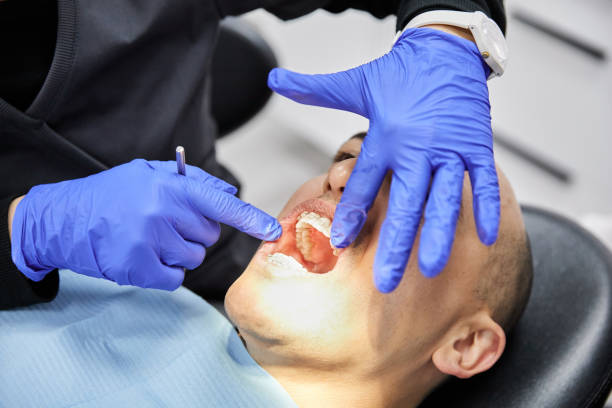 Best Emergency Dental Care for Broken or Chipped Teeth in Waxahachie, TX